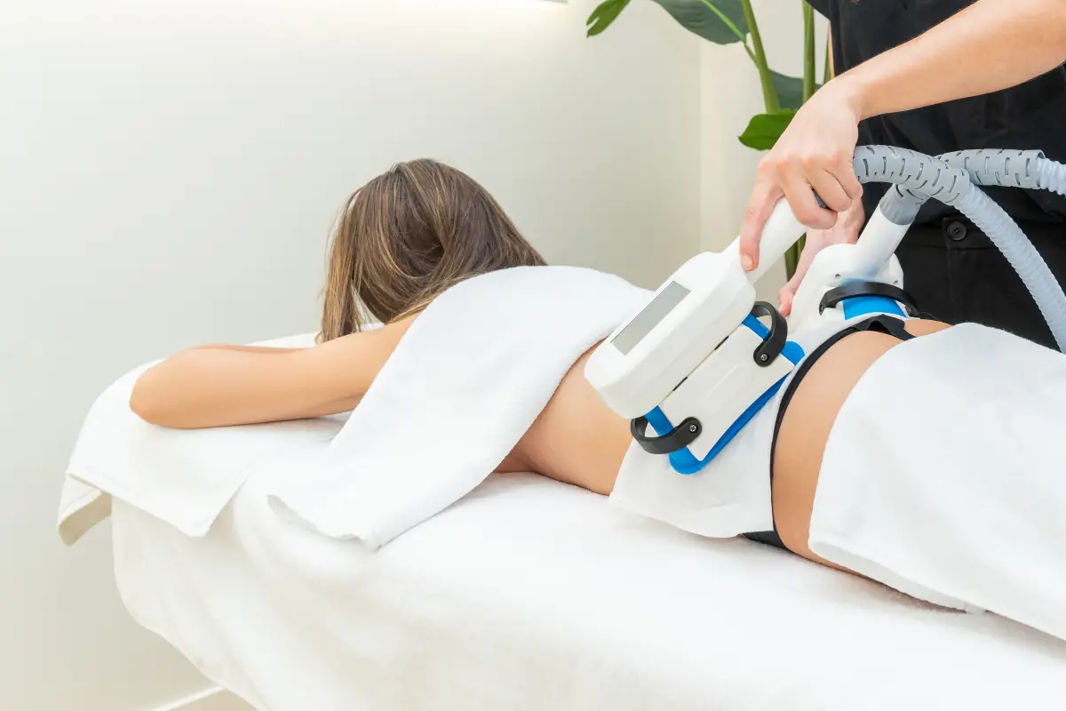 Quels sont les résultats de la cryolipolyse ?